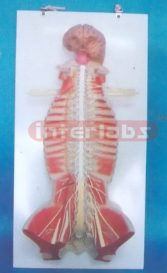 SMALL HANGING, ADVANCED HUMAN SPINAL CORD MODEL IN SPINAL CANAL